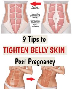 9 TIPS TO TIGHTEN BELLY SKIN POST PREGNANCY