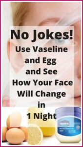 1 Night Challenge – VASELINE and EGG Mask – Transforms Your Face In one Night